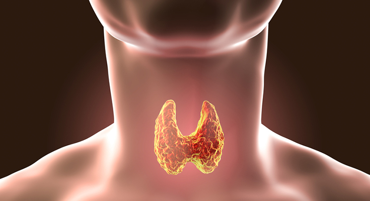 Hyperthyroidism Symptoms