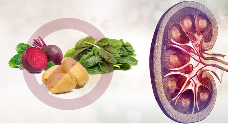 Foods You Should Avoid In Kidney Stones!