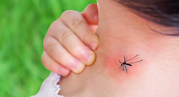 Everything You Need To Know About Dengue – Symptoms, Treatments, Causes