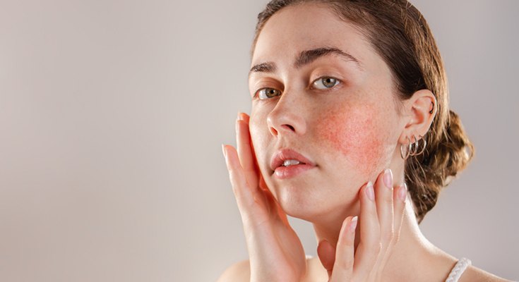 5 Types of Skin Disorders and Best Possible Treatments!