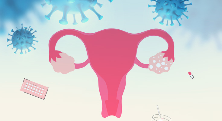 What Is The Link Between Covid-19 & PCOS?