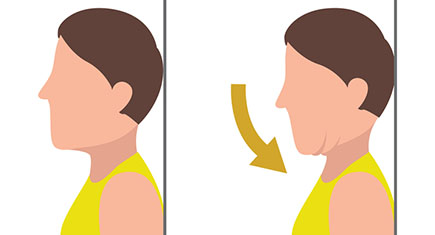 Exercise For Cervical