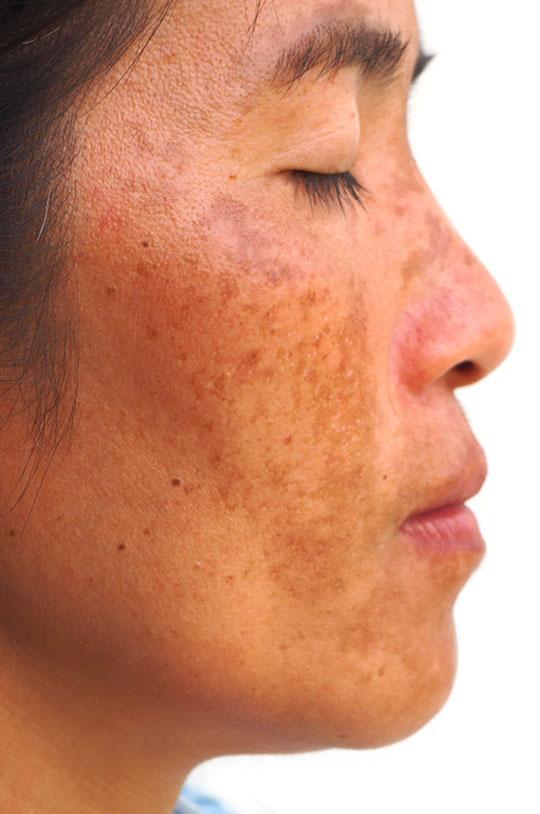Skin Care Symptoms
